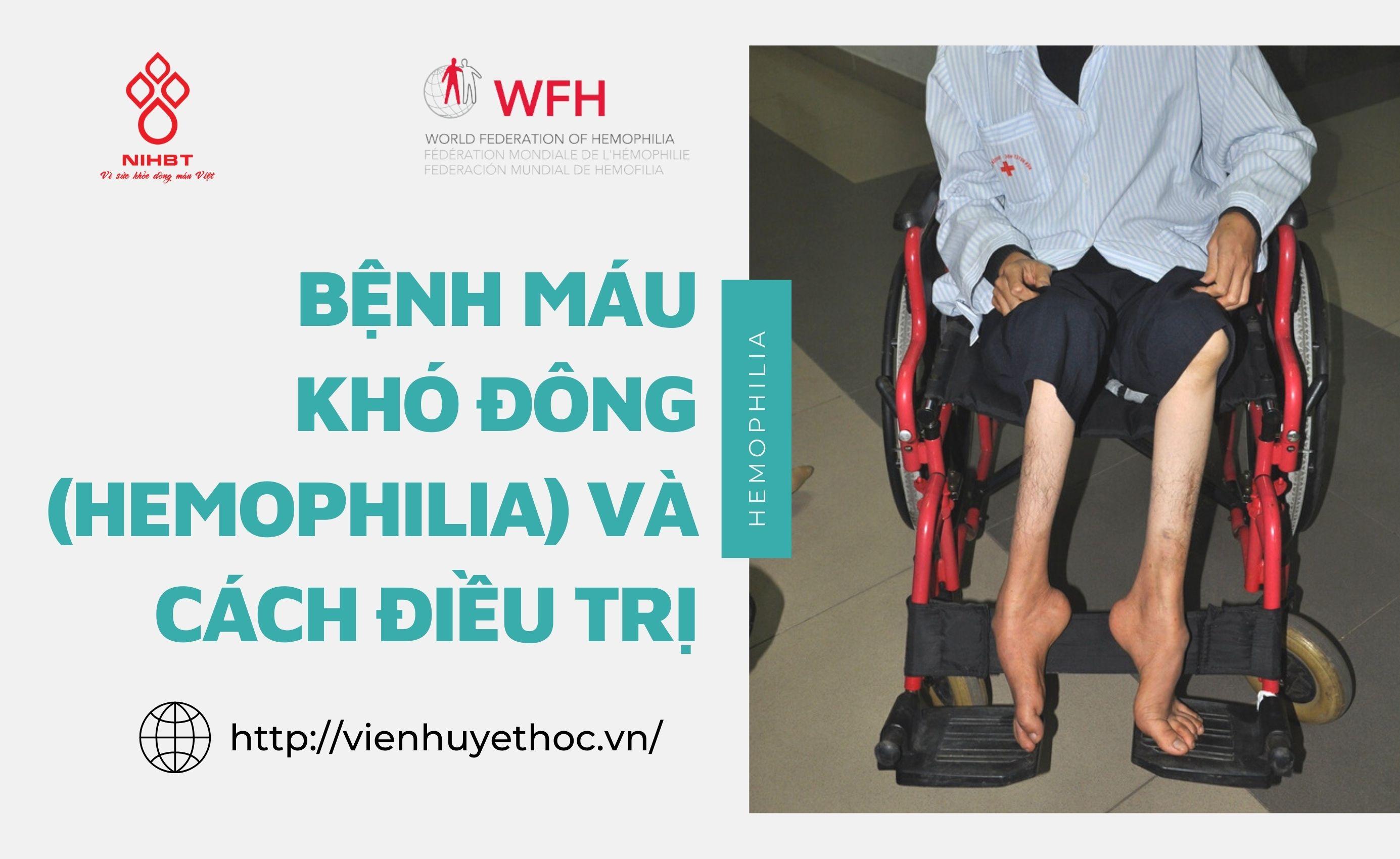Vị trí xuất hiện máu trong giấc mơ